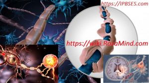 عامل‌های محیطی تصلب‌چندگانه: شکل‌گیری پیشرفت MS